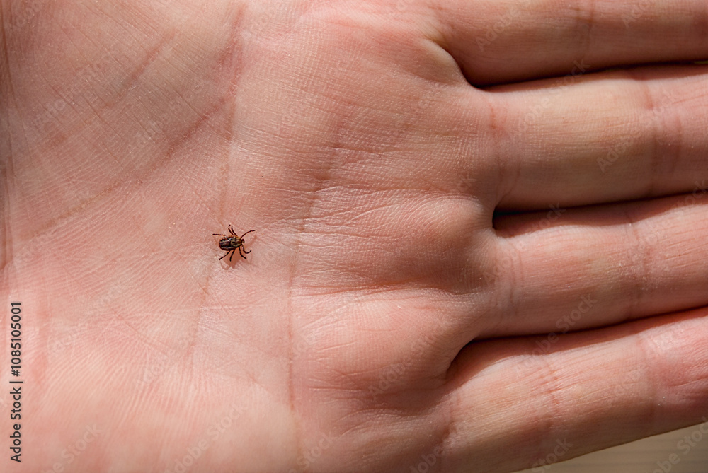 Obraz premium The tick Ixodes ricinus crawling on human skin. Encephalitis tick.