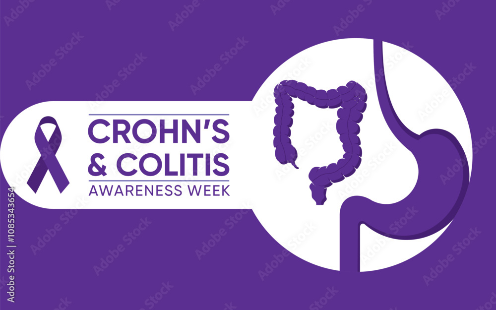 Crohn’s and Colitis Awareness Week is observed annually from December 1 to December 7. Crohn’s and Colitis Awareness Week is observed annually from December 1 to December 7.