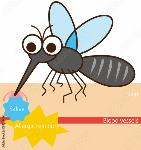 mosquito déformer Bloodsucking　figure photo