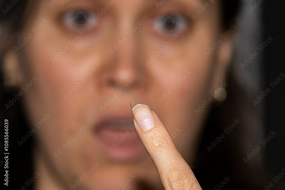 Broken nail on a woman's hand. Close-up of a broken nail on the index finger. Broken nail on a woman's hand. Close-up of a broken nail on the index finger.