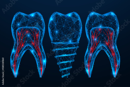 Dental implant. Polygonal design of interconnected lines and dots. Blue background.