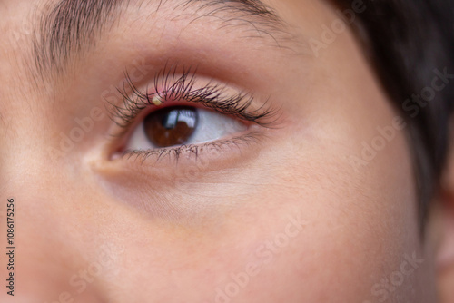 Close-up of human eye with small stye on upper eyelid. Macro shot of irritated eye and lashes. Health and medical concept