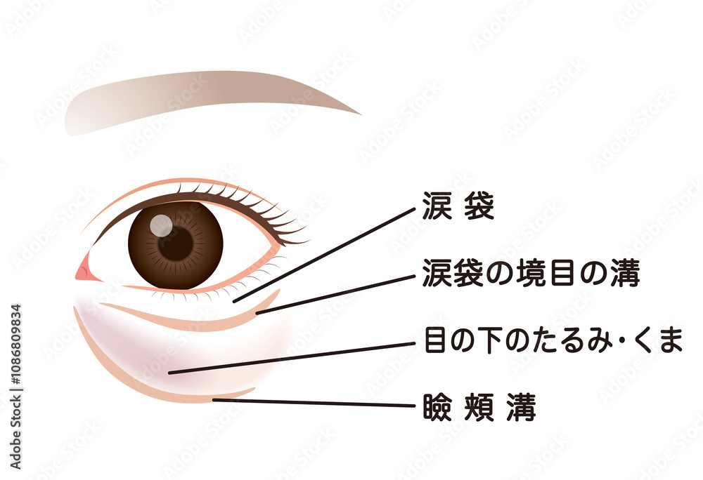 Obraz premium 目の下のたるみ たるんだ下まぶた