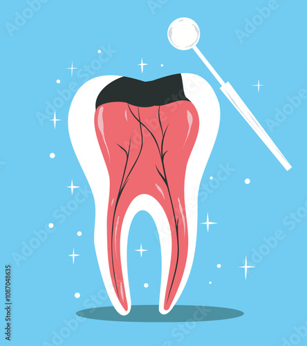 Dental caries with pain on red painful gum. Concept of tooth cavity, toothache, dental care. Dentistry, oral health, dentist. Flat vector illustration