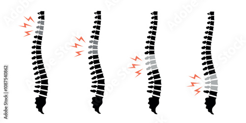 Spinal column illustration with highlighted pain areas in red.