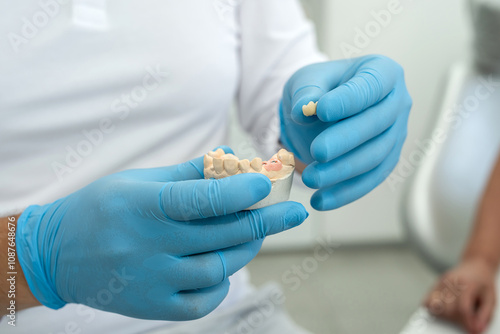 Tableau sur toile dentist holds an implant and consults an elderly woman with the installation of