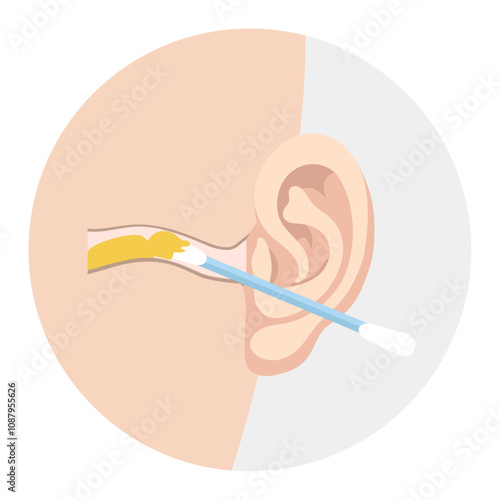 Ear wax  with using ear stick anatomy