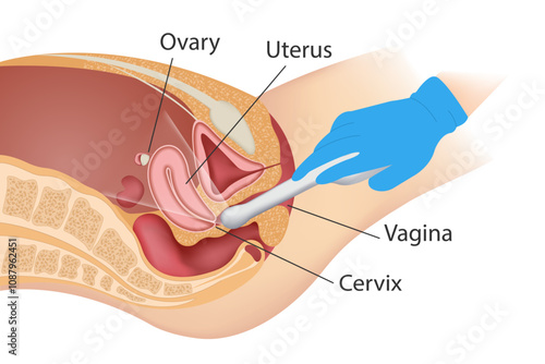 Transvaginal ultrasound scanner of the internal pelvic organs. The concept of women's health