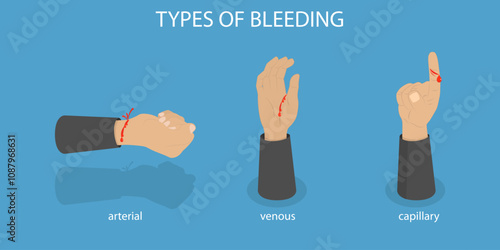 3D Isometric Flat Vector Illustration of Types Of Bleeding, Human Hands with Different Wounds
