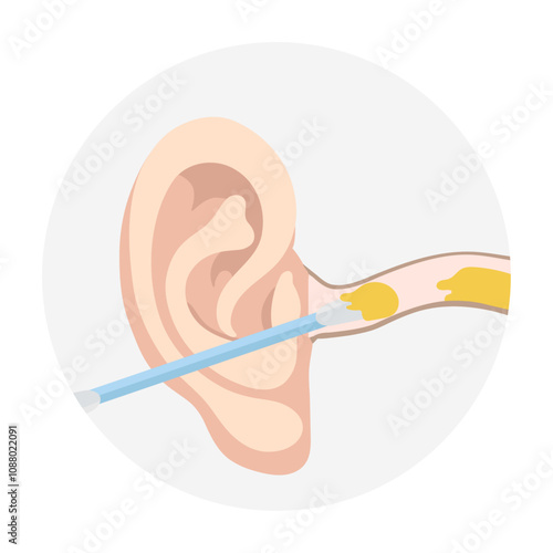 Ear wax  with using ear stick anatomy
