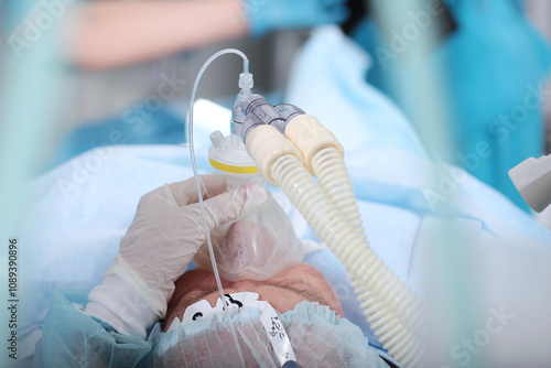 Breathing tube in patient's mouth during surgery. Anesthesia before surgery. An elderly man in operating room photo