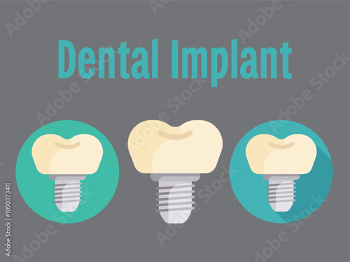 dental implant abutment fixture teeth tooth collection