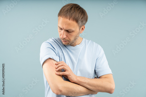Картината върху платно Frustrated man scratches arm with red streaks from itching suffering allergic reaction, food sensitivities, contact dermatitis, eczema or insect bites
