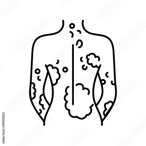 Psoriasis color line icon. Autoimmune diseases.