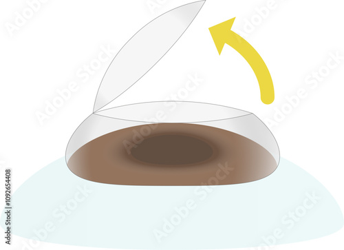 視力矯正手術で角膜のフラップを開くイメージのイラスト