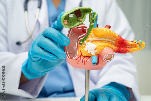 Pancreatitis, pancreatic cancer, Asian doctor with pancreas, gallbladder and bile duct human anatomy model at hospital.