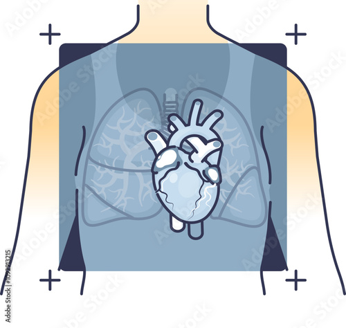 Illustration of a heart and lungs in a chest X-ray, symbolizing medical diagnostics.