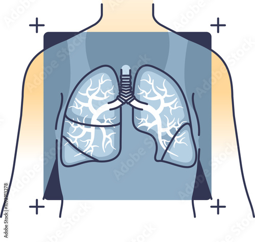 Illustration of human lungs in a chest X-ray view, highlighting respiratory health.