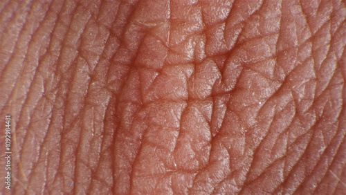 Human skin under a microscope.