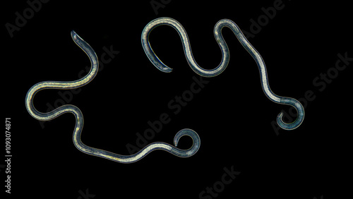 Nematoda worm under a microscope, type Protostomia. There are both parasitic and free-living