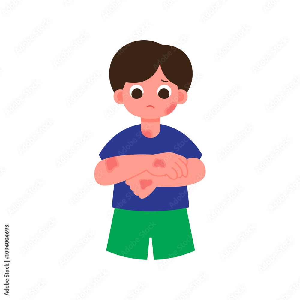 Eczema of Symptoms 2 Red, Brownish Patches Eczema of Symptoms 2 Red, Brownish Patches