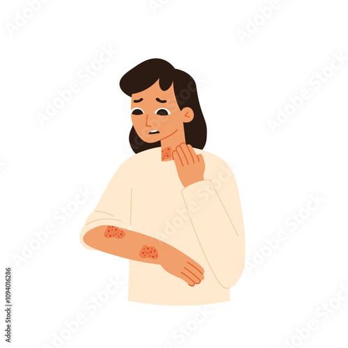 Autoimmune Disorder Symptoms in Woman Skin Rashes