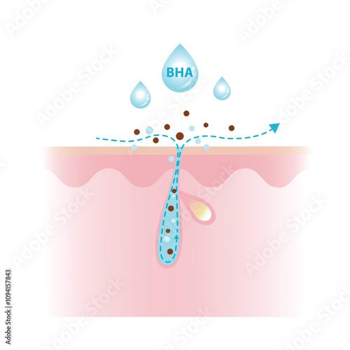 Beta Hydroxy Acids characteristics vector illustration on white background. BHA penetrate deep into the pore, unclogs, dissolving excess oil, debris and oil soluble. Skin care and beauty concept.