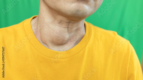 Thyroid gland inflammation at neck, goiter, throat cancer, sore throat and cough, man with neck pain on green, neck health problems concept