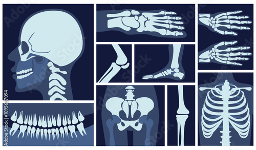 Xrays images set. X rays with bones, skull, pelvis, arms and legs. Arthritis and osteoarthritis. Diagnosis and treatment. Healthcare and medicine. Flat vector collection