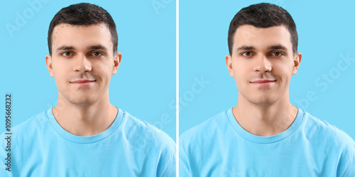 Young man before and after ...