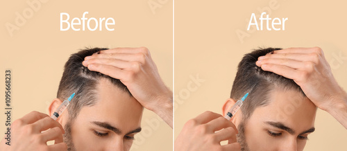Young man before and after ...