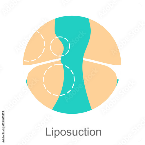 Liposuction