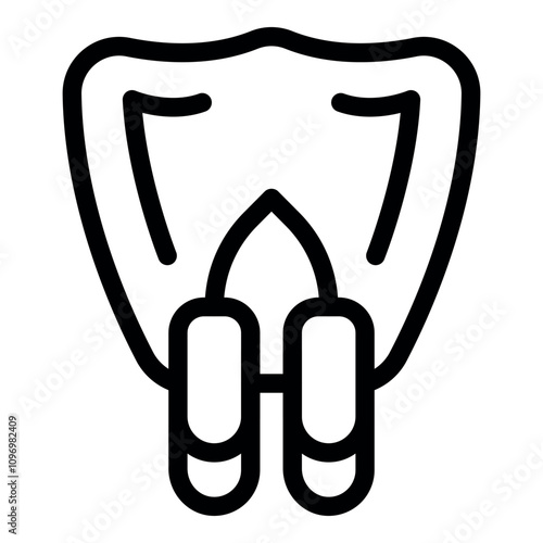 Dental implants showing gingivitis and periodontitis connected by bridge with visible parodontitis