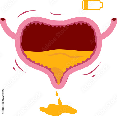 Bladder disease illustration. Urinary tract infection. Bladder cancer. Bladder stones. Bladder inconvenience.
