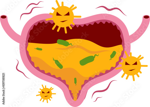 Bladder disease illustration. Urinary tract infection. Bladder cancer. Bladder stones. Bladder inconvenience.