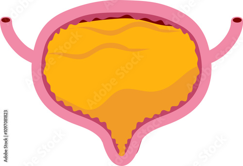 Bladder disease illustration. Urinary tract infection. Bladder cancer. Bladder stones. Bladder inconvenience.