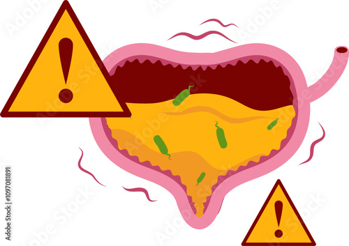 Bladder disease illustration. Urinary tract infection. Bladder cancer. Bladder stones. Bladder inconvenience.