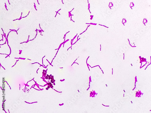 Foto Streptococcus pneumonia bacteria cells and candida albican fungus form hemoculture micrograph