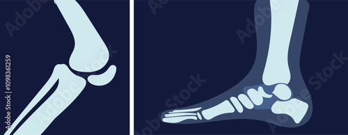 X rays image with bone. Xray of feet and knee. Diagnosis and treatment. Healthcare and medicine. Graphic element for website. Flat vector illustration