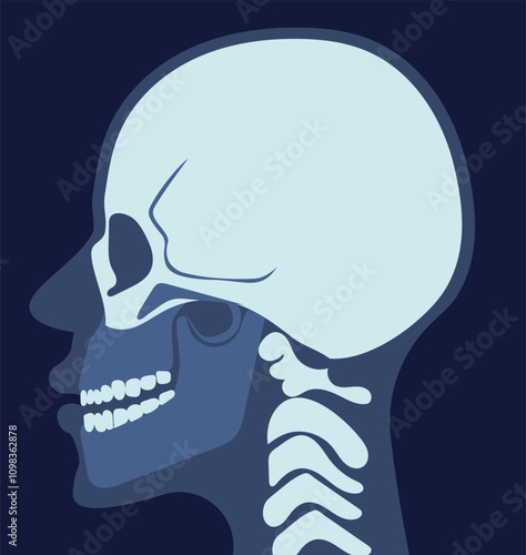 X rays image with bone. Xray of skull. MRI brain concept. Diagnosis and treatment. Healthcare and medicine. Human anatomy. Flat vector illustration
