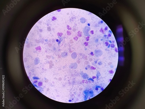 Canvas Print Trichomonas is a genus of anaerobic excavate parasites of vertebrates