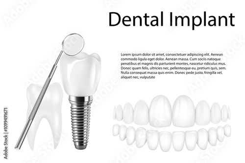 Dental implant structure medical pictorial educative infographic poster with molar replacement end healthy tools models vector illustration.