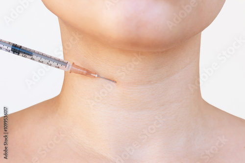 Syringe needle for lifting procedure on woman's neck with wrinkles, age-related changes, lines, rings of Venus on white background. Hypertonus of cervical muscles. Close up photo