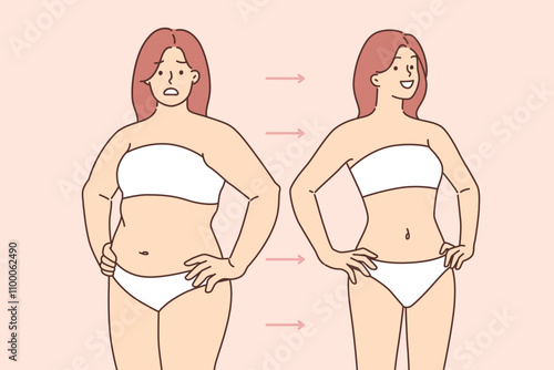Fat woman has lost weight and acquired beautiful figure thanks to liposuction or regular fitness