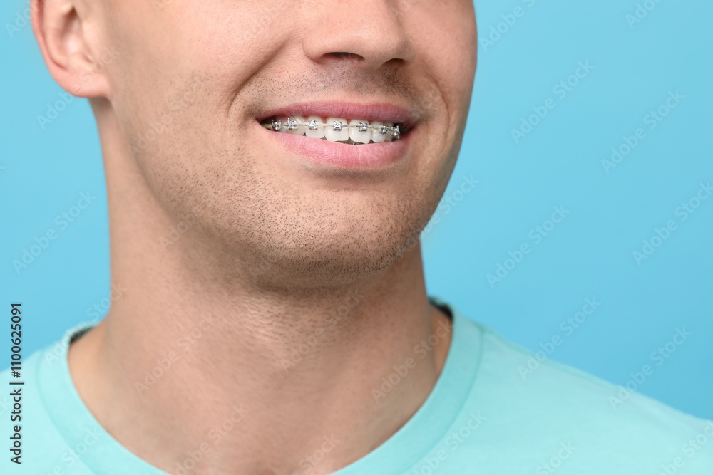 Obraz premium Man with dental braces on light blue background, closeup