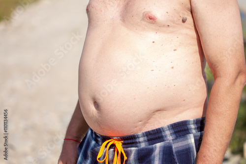 Big belly in a man. Close-up front view of a male body, shirtless, big belly, bloating, arms pressed to the body, belly button. Obesity, poor nutrition. photo