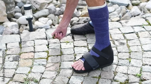 man with broken leg in purple fiberglass, weeding garden stone path, he has special sandals on his foot for walking, active lifestyle concept,