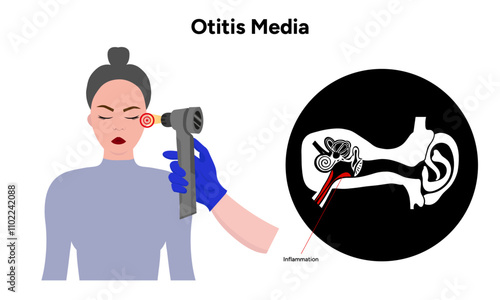 Otitis media inflammation anatomy human ear pain disease medical infographic and check up in doctor appointment 