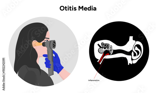 Otitis media inflammation anatomy human ear pain disease medical infographic and check up in doctor appointment 