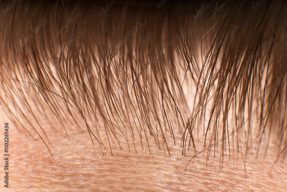 Obraz premium The Hair line on the man forehead - macro close up